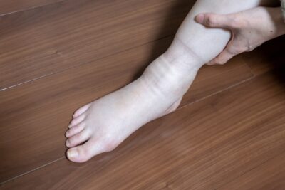 足のむくみが気になる方へ｜下肢浮腫の原因と心臓病との関係のアイキャッチ画像