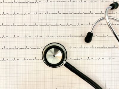 健診で心電図異常と言われたら?放置してはいけない理由と循環器内科で受けるべき検査のアイキャッチ画像